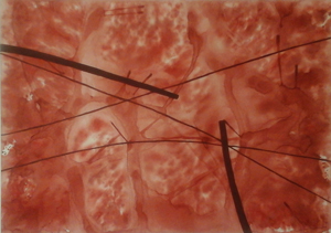 Thumbnail Placeholder